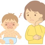 赤ちゃんが汗疹(あせも)に？写真や対策はどうすれば？